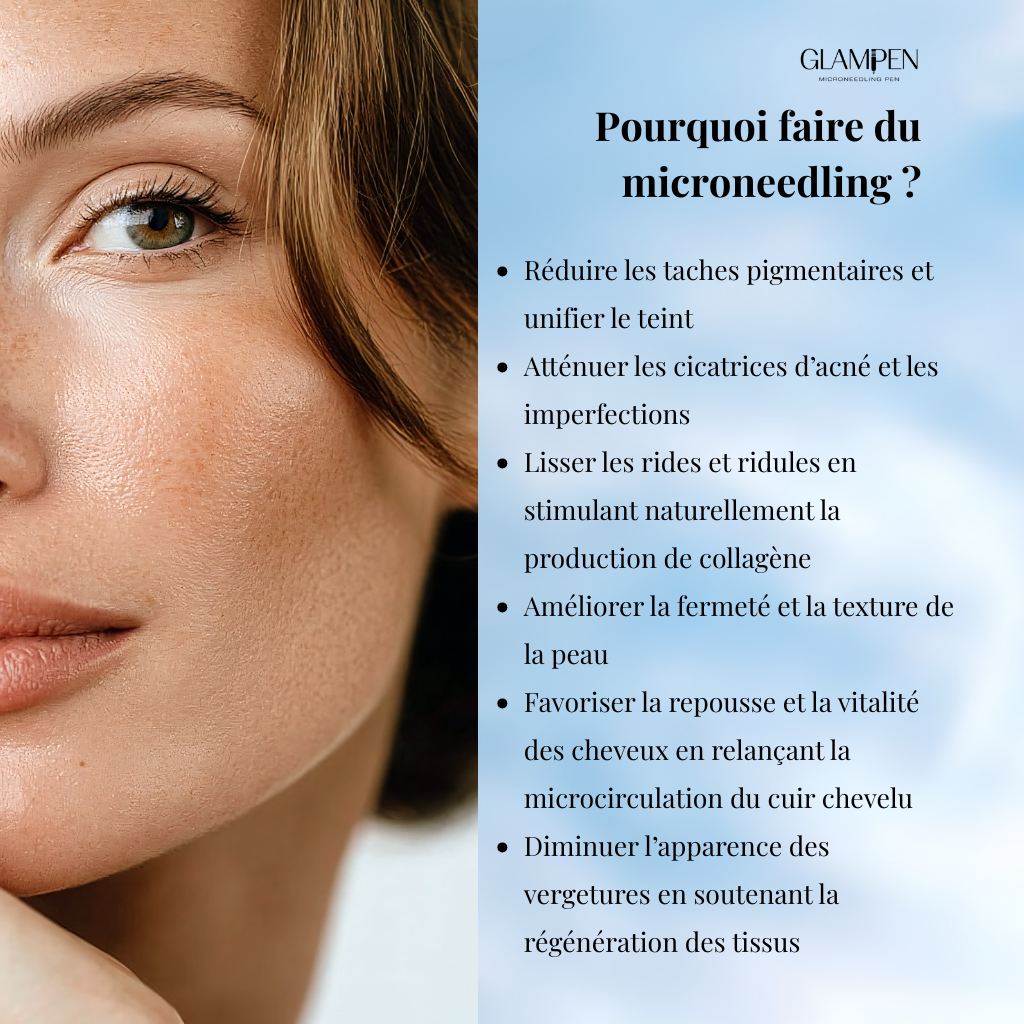 Recharge Nano aiguilles (Boîte de 10)