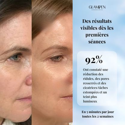 Biopen microneedling EMS LED