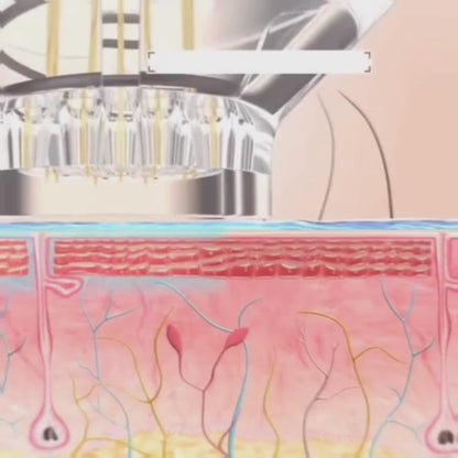 Biopen microneedling EMS LED